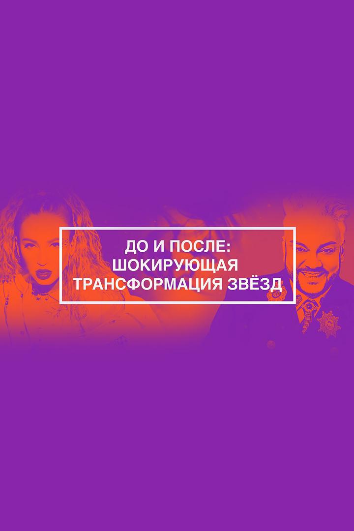До и после: Шокирующая трансформация звёзд