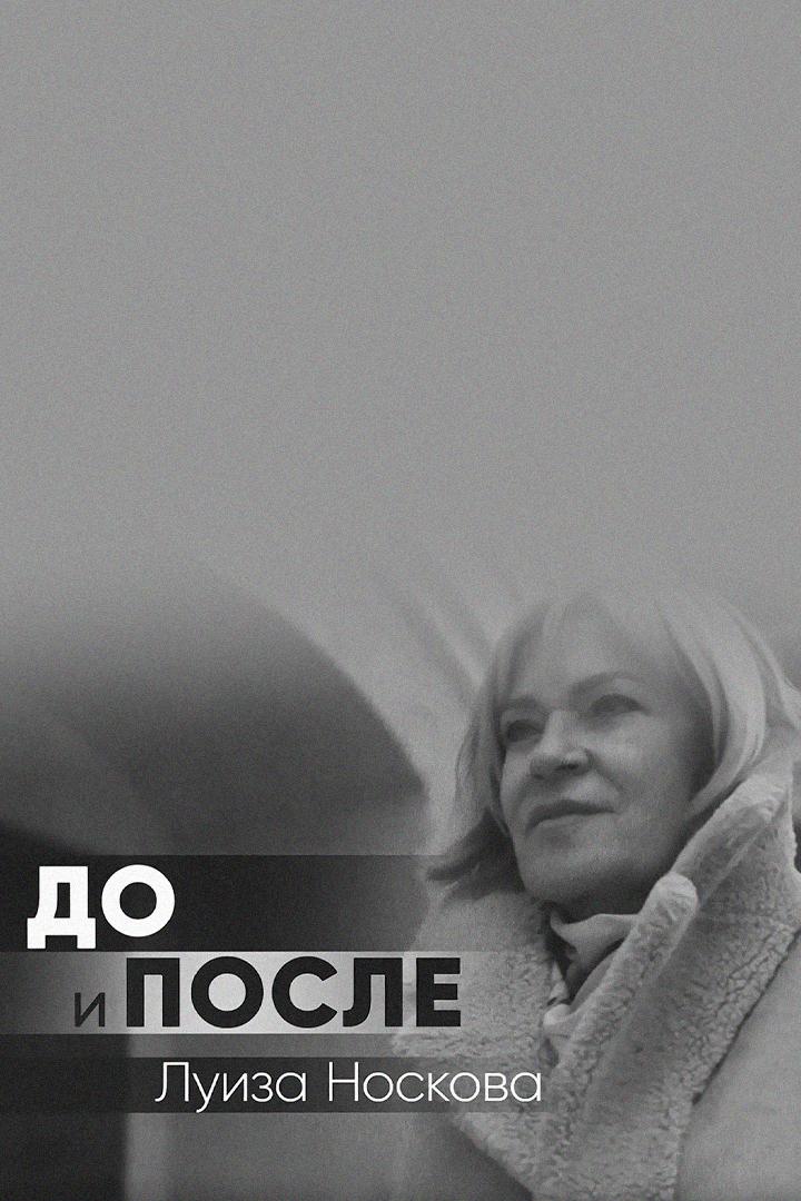 До и после. Луиза Носкова